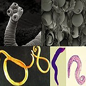 Parasites - human